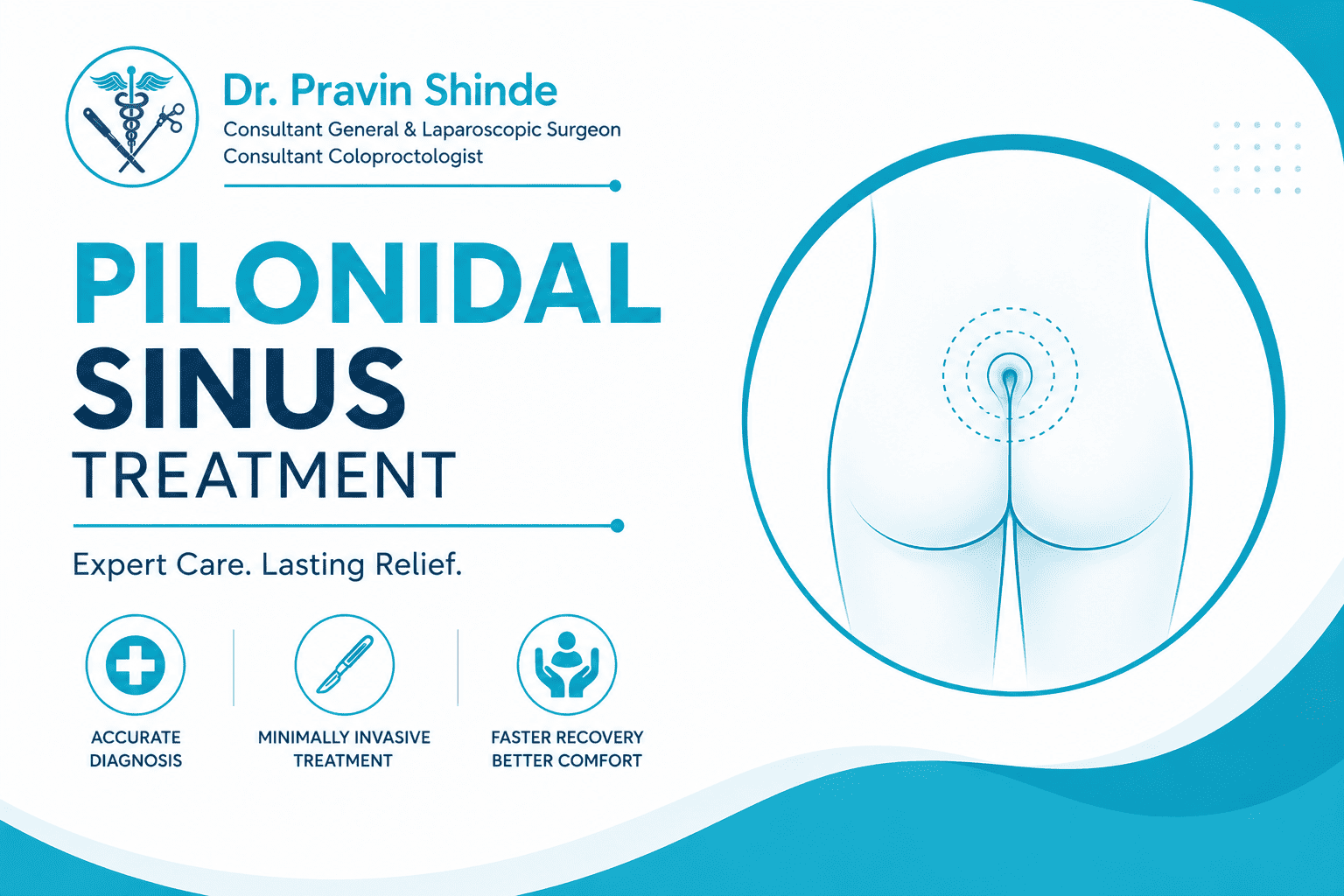 Best Pilonidal Sinus Treatment Specialist in Sion